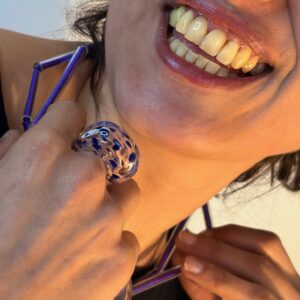 Anillo Dálmata